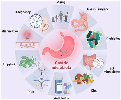 The role of gastric microecological dysbiosis in gastric carcinogenesis